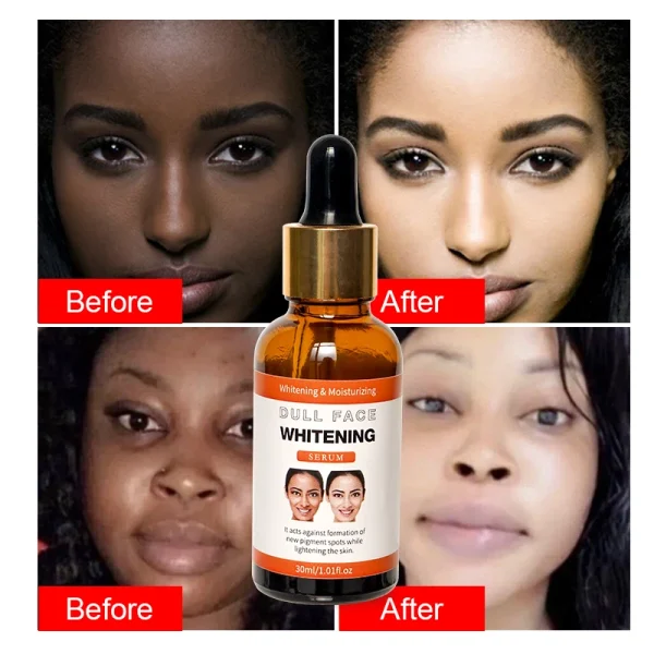 Private Label Organic Natural Facial Serum Firm Vegan Heals Dry Skin SkinCare Hydrates Tone Skin Face Care Arbutin Serum