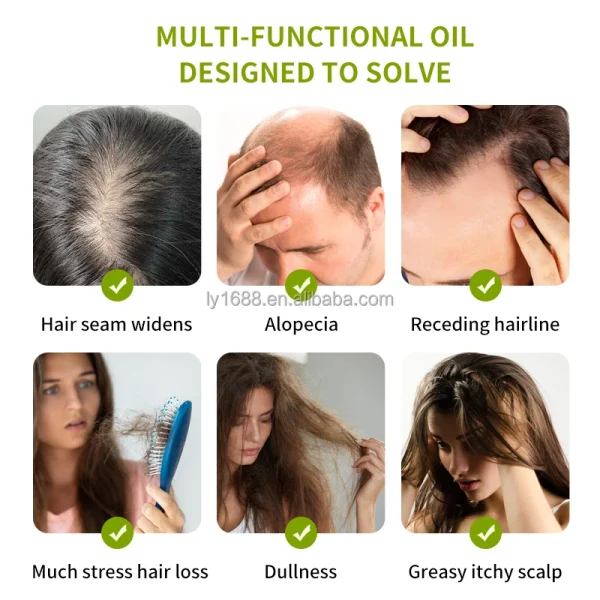 100% Natural Herbal Hair Care Oil Private Label Scalp Strengthening Rosemary Mint Oil with Organic Ginger for Hair Growth - Image 3
