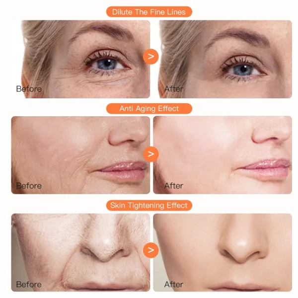 Private Label Xylane Pro Cream Collagen Anti Aging Rapid Wrinkle Repair Regenerating Moisturizer Lotion Renewing Face Neck Cream - Image 2