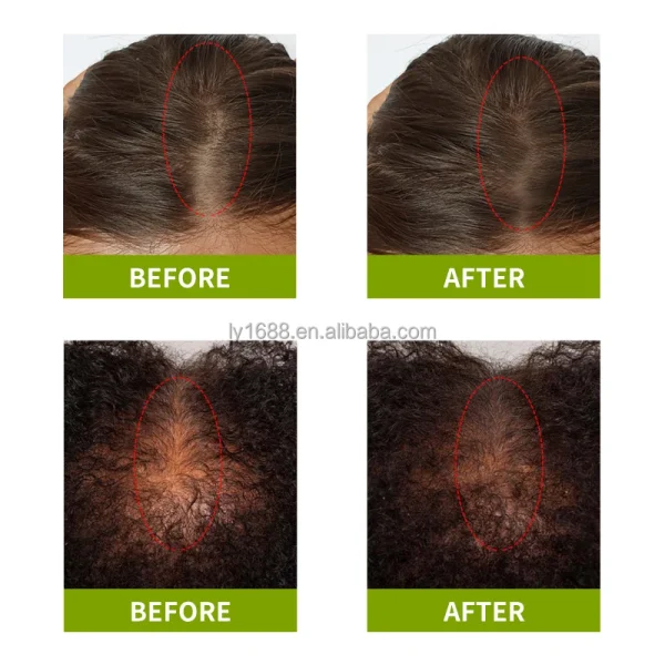 100% Natural Herbal Hair Care Oil Private Label Scalp Strengthening Rosemary Mint Oil with Organic Ginger for Hair Growth - Image 2