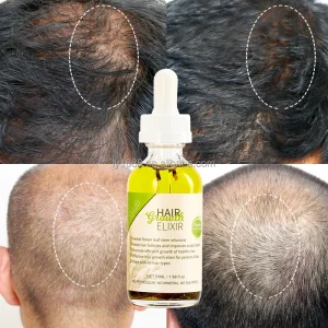100% Natural Herbal Hair Care Oil Private Label Scalp Strengthening Rosemary Mint Oil with Organic Ginger for Hair Growth
