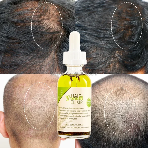 100% Natural Herbal Hair Care Oil Private Label Scalp Strengthening Rosemary Mint Oil with Organic Ginger for Hair Growth