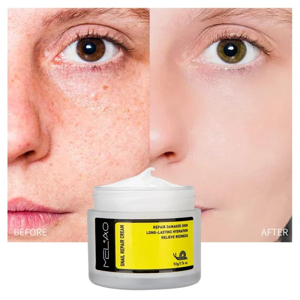 Korean Skin Care Beauty Product Cosmetic Anti Aging Vitamin c Whitening Peptides Face Care Snail Mucin Cream Serum Skin Care Set - Image 3