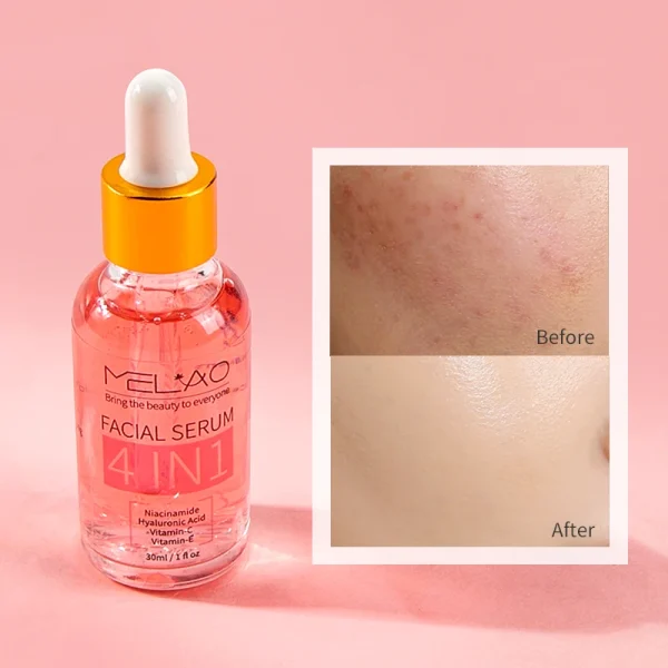 4 in 1 Face Serum Toner Anti Aging Moisturizer Retinol Vitamin C Peptides Korean Skin Face Care Whitening Serum Beauty Products - Image 4
