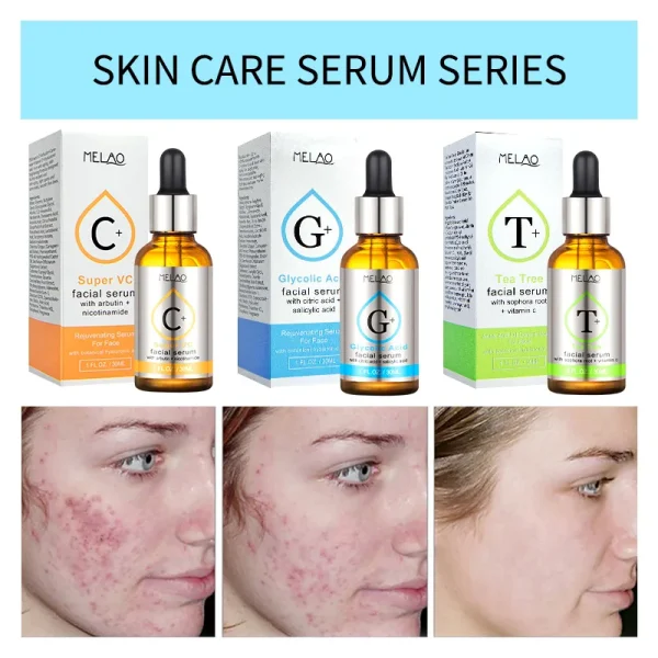 Serum Vitamin C Glycollic Acid Nicotinamide Tea Tree Oil Serum Hyaluronic Acid and Retinol Serum With Glass Bottle 30ml - Image 4