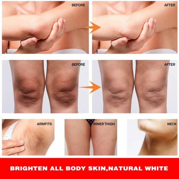 Private Label Extreme Whitening Anti Dark Spot Aging Wrinkle Knees Elbows Strong Vitamin White Lotion Face Body Whitening Cream - Image 6