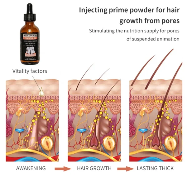 OEM 60ml 30 Days Efficient Hair Growth Moroccan Oil Anti Hair Loss Treatment Natural Organic Hair Loss Regrowth Serum - Image 3