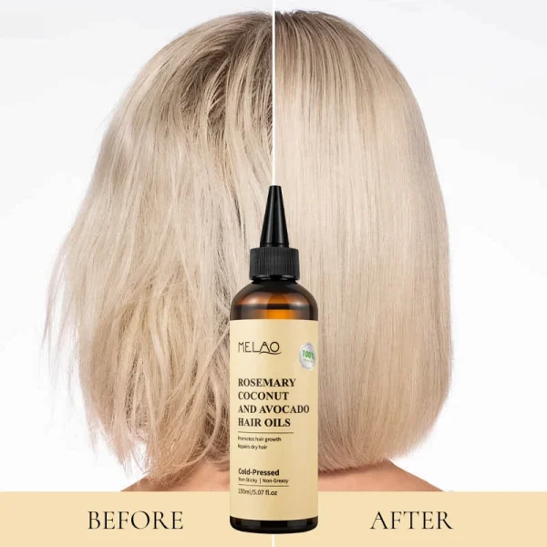 Rosemary Essential Hair Loss Oil Growth Oil Hair Strengthening Dandruff Itchy Deep Rosemary Coconut Avocado Hair Oil - Image 6