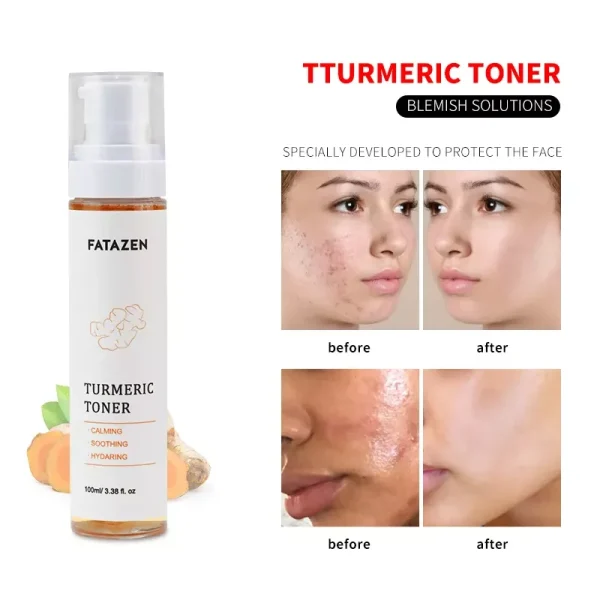 Free Sample Turmeric Dark Spots Toner Spots Eraser Corrector Turmeric Fades Blemishes Dark Spots Remover Acne Remover Toner - Image 4
