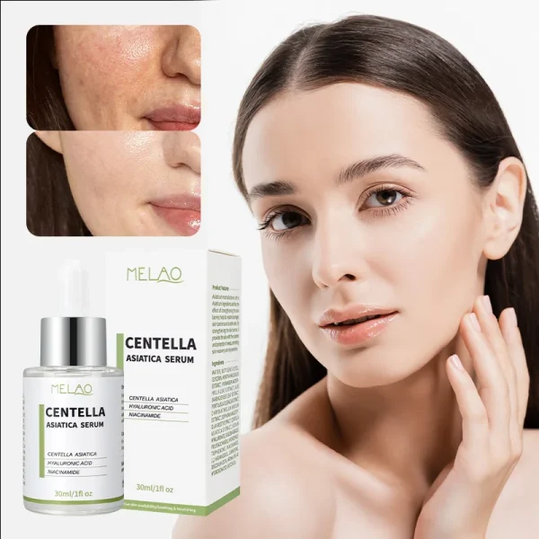 Moisturizes Treatment Soothing Anti Aging Akorean Cosmetic Whitening Vitamin c Skin Care Centella Asiatica Serum for Face - Image 5