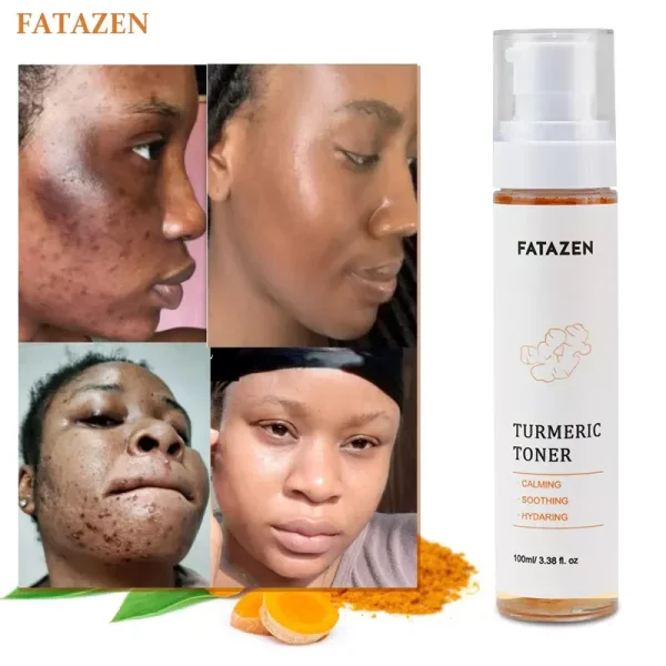 Free Sample Turmeric Dark Spots Toner Spots Eraser Corrector Turmeric Fades Blemishes Dark Spots Remover Acne Remover Toner