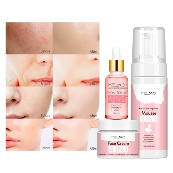 Collagen Moisturizing Face Cream Lotion Skin Repair Freckle Face Cream 4 in 1 Face Cream - Image 3