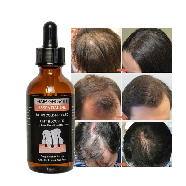 OEM 60ml 30 Days Efficient Hair Growth Moroccan Oil Anti Hair Loss Treatment Natural Organic Hair Loss Regrowth Serum - Image 4