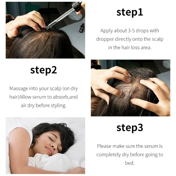 OEM 60ml 30 Days Efficient Hair Growth Moroccan Oil Anti Hair Loss Treatment Natural Organic Hair Loss Regrowth Serum - Image 5