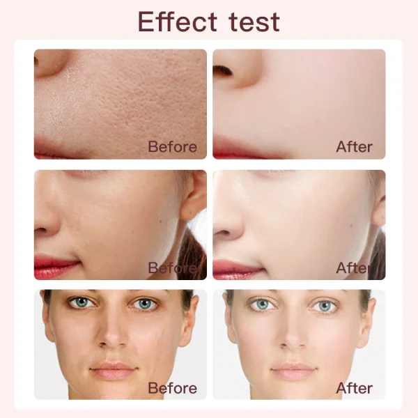 Wholesale Skin Care Deep Moisturizing Acne Remover Rose Facial Toner Private Label Organic Skincare Custom Rose Water Face Toner - Image 2