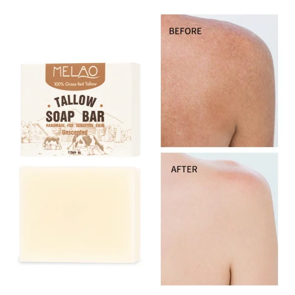 Facial Cleanser Vitamins Moisturizing Anti Aging Korean Cosmetic Beauty Face Whitening Skin Care Products Beef Tallow Soap - Image 3