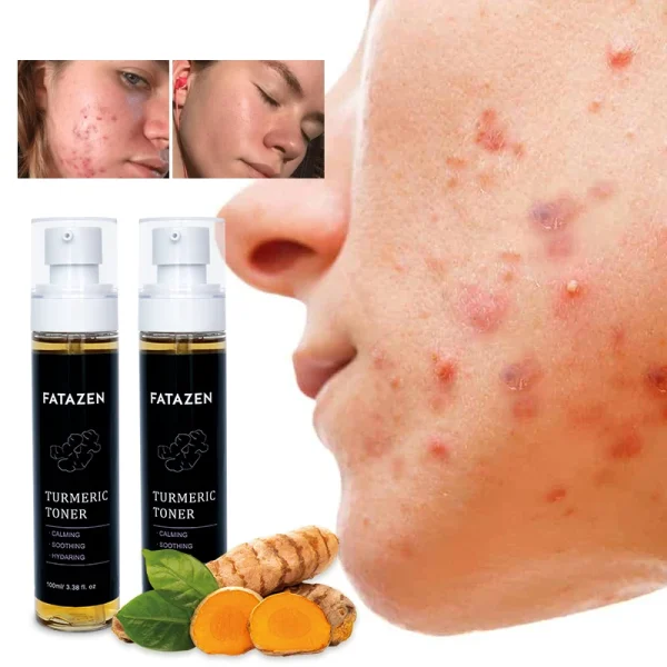Hot Sell Skin Care Products Dark Spots Turmeric Toner Spots Eraser Corrector Turmeric Fades Blemishes Acne Remover Facial Toner