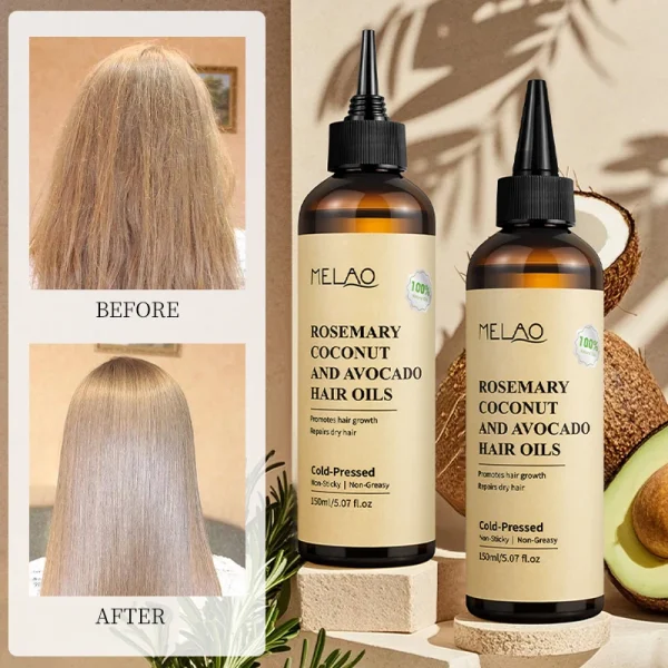 Rosemary Essential Hair Loss Oil Growth Oil Hair Strengthening Dandruff Itchy Deep Rosemary Coconut Avocado Hair Oil - Image 4