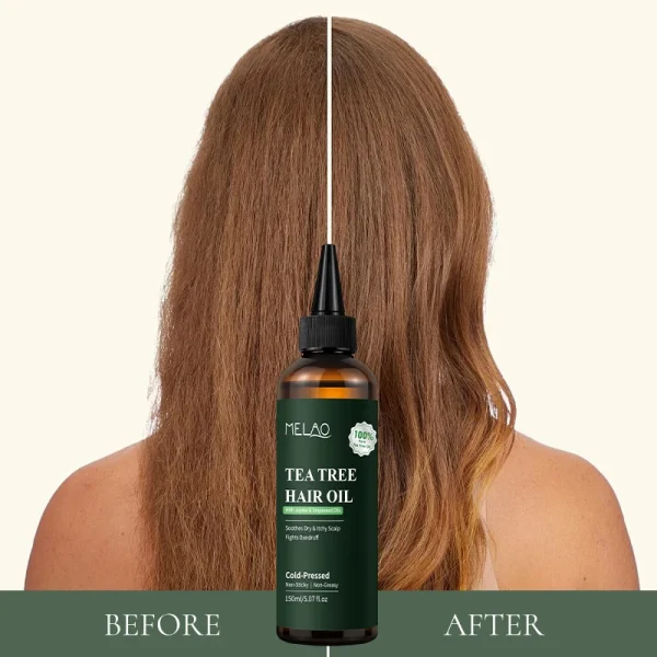 Private Label Rosemary Essential Hair Loss Oil Growth Oil Hair Strengthening Dandruff Itchy Deep Tea Tree Hair Oil - Image 2