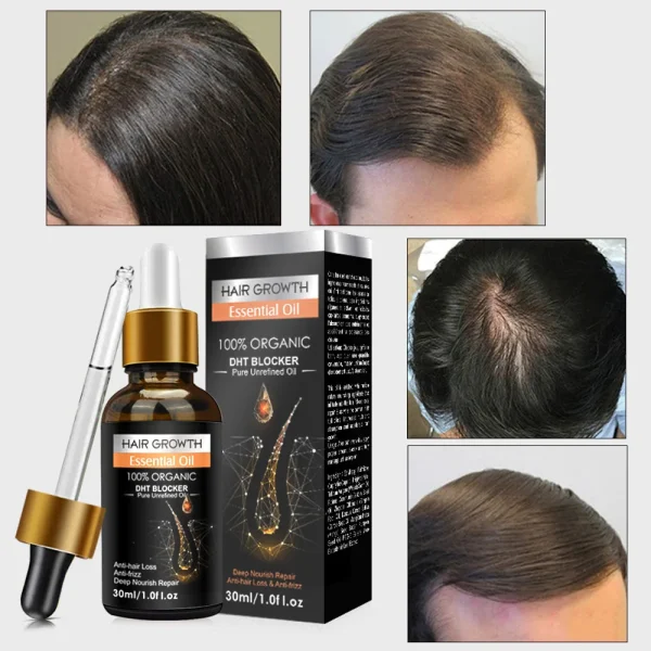Custom Logo Private Label All Natural Formula Hair Growth Oil Serum Nourishing Scalp Rapid Hair Thickening Oil Organic Hair Oil - Image 2