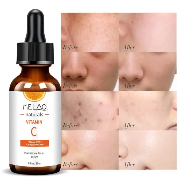Melao Beauty Hyaluronic Acid Anti Aging Whitening Face Care Cosmetic Korean Skin Care Products Peptides Vitamin c Serum for Face - Image 2