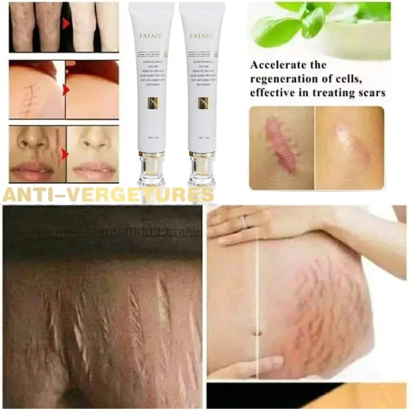 FATAZEN Private Label Organic Natural Herbal Skin Repairing Cream Pregnancy Stretch Mark Pimple Repair Acne Scar Removal Cream - Image 5