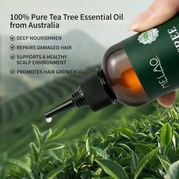 Private Label Rosemary Essential Hair Loss Oil Growth Oil Hair Strengthening Dandruff Itchy Deep Tea Tree Hair Oil - Image 4