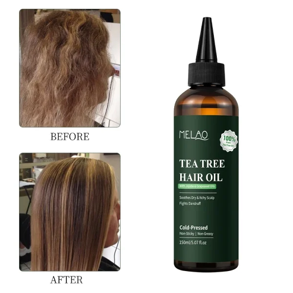 Private Label Rosemary Essential Hair Loss Oil Growth Oil Hair Strengthening Dandruff Itchy Deep Tea Tree Hair Oil - Image 6