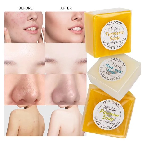 Facial Cleanser Vitamins Anti Aging Korean Skin Care Cosmetic Beauty Face Skin Care Whitening Skin Care Products Turmeric Soap - Image 3