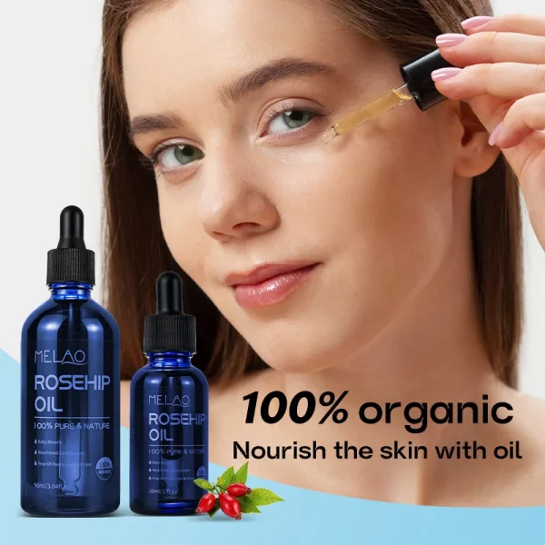 100% Pure Natural Moisturizing Body Hair Facial Organic Cold Pressed Rosehip Oil - Image 4