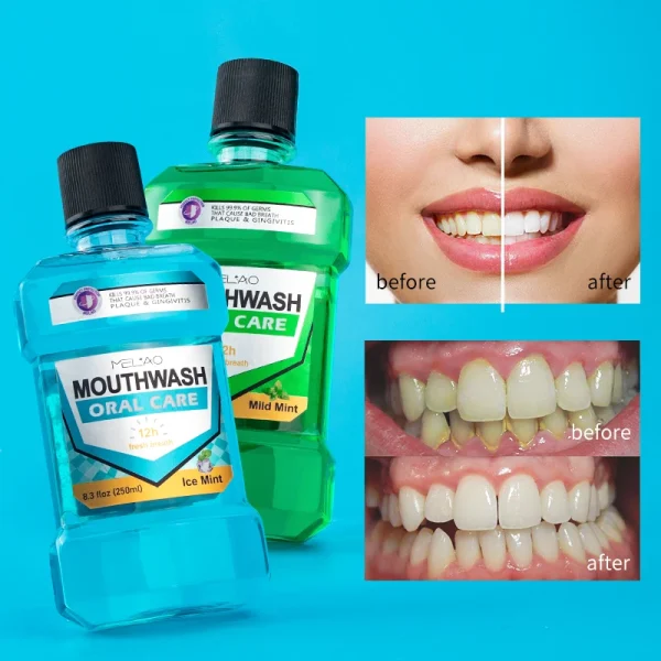 Private Label Cool Mint Mouth Wash Flavor Customize Oral Wash Teeth Cleaning Whitening Mouthwash Manufacturer - Image 3