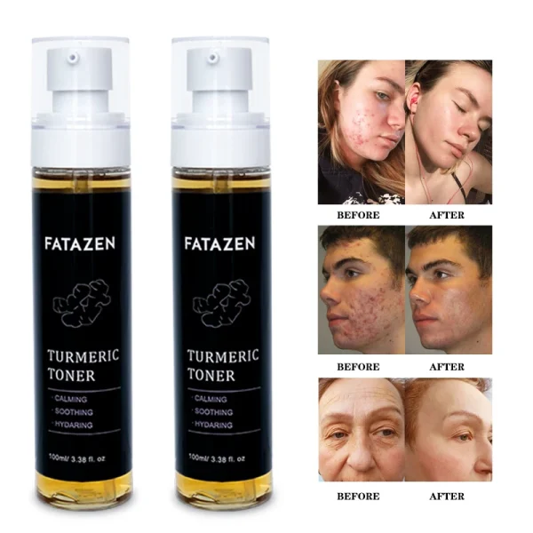 Hot Sell Skin Care Products Dark Spots Turmeric Toner Spots Eraser Corrector Turmeric Fades Blemishes Acne Remover Facial Toner - Image 6