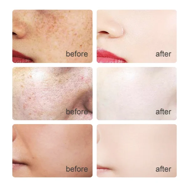 Anti Aging Lift Brightening Skin Care Hyaluronic Acid Vitamin C E Peptide Collagen Facial Glycyrrhiza Glabra Whitening Serum - Image 6