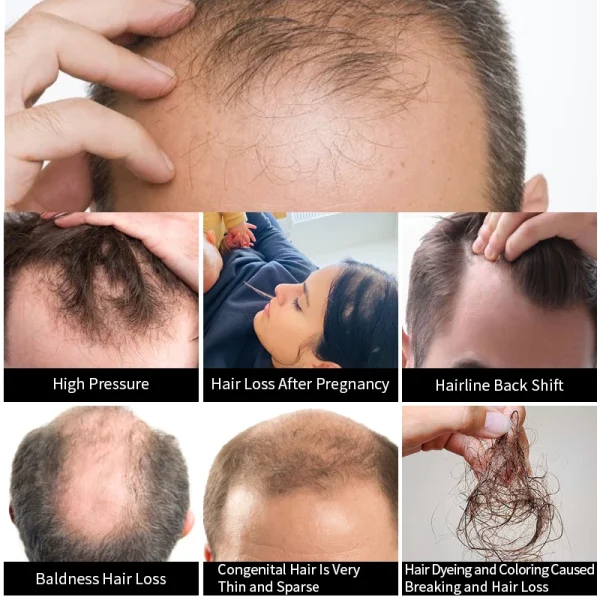 OEM 60ml 30 Days Efficient Hair Growth Moroccan Oil Anti Hair Loss Treatment Natural Organic Hair Loss Regrowth Serum - Image 2