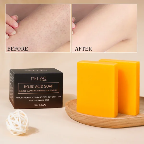 2023 Wholesale in Stock Kojic San Best Popular Brightening Whitening Acne Treatment Soap Skin Lightening Soap - Image 3