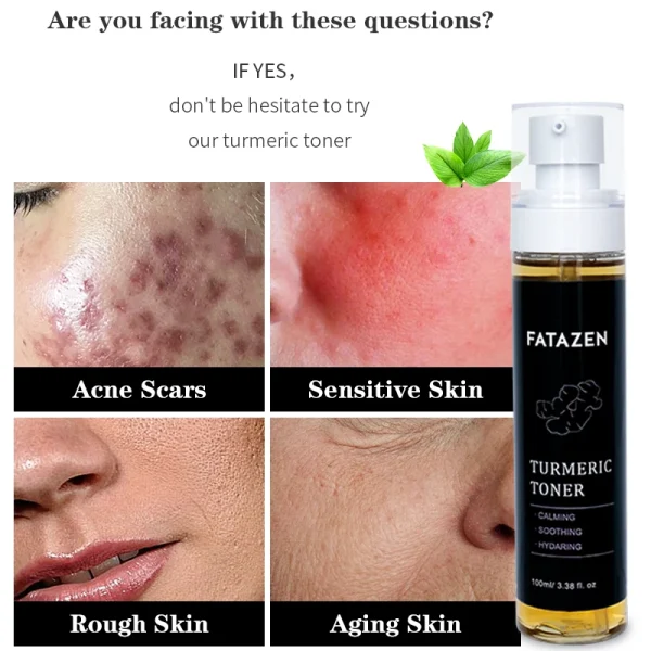 Hot Sell Skin Care Products Dark Spots Turmeric Toner Spots Eraser Corrector Turmeric Fades Blemishes Acne Remover Facial Toner - Image 5