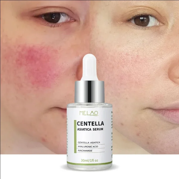 Moisturizes Treatment Soothing Anti Aging Akorean Cosmetic Whitening Vitamin c Skin Care Centella Asiatica Serum for Face - Image 3