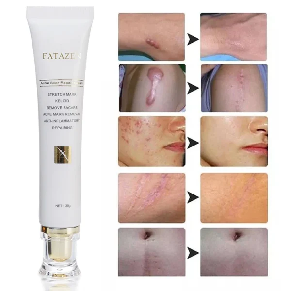 FATAZEN Private Label Organic Natural Herbal Skin Repairing Cream Pregnancy Stretch Mark Pimple Repair Acne Scar Removal Cream