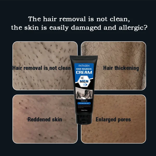 Pirvate Label Organic Natural Herbal Hair Removal Cream for Men Depilatory OEM Laser Hair Remove Cream Hair Removal Appliances - Image 3
