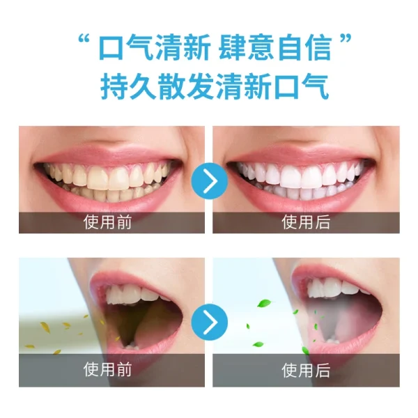 Dental Care Kit Tooth Vitamin E Dental Whitener Oral Care Hotel Amenities Teeth Whitening Kit Products Mouth Wash Mouthwash - Image 6