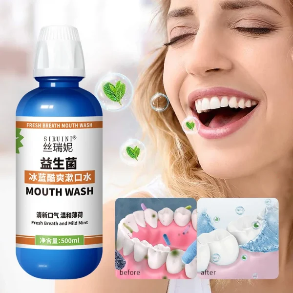 Siruini Private Label Mouthwash 500ml Healthy Gums Clean Mild Cool Mint Antigingivitis Dentist Formulated Mouth Wash - Image 6