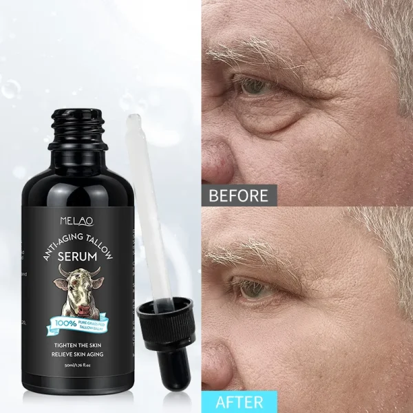 Face Lifting Serum Moisturizing Best Serum for Men Pore Shrinking Anti Aging Tallow Face Serum Face Care - Image 4