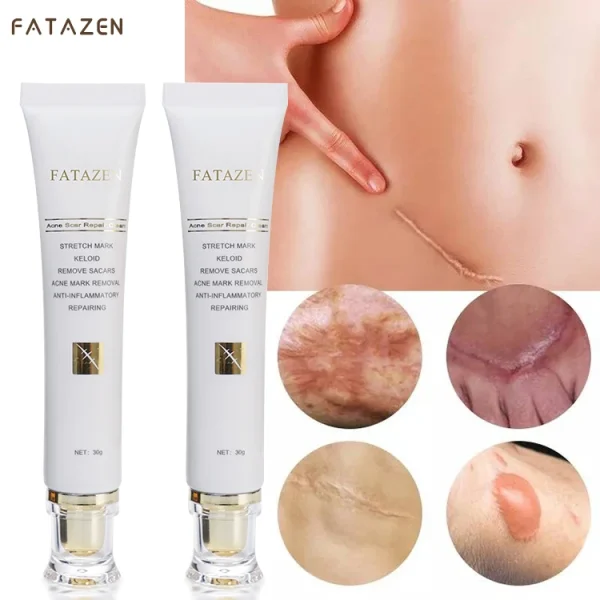 FATAZEN Private Label Organic Natural Herbal Skin Repairing Cream Pregnancy Stretch Mark Pimple Repair Acne Scar Removal Cream - Image 4
