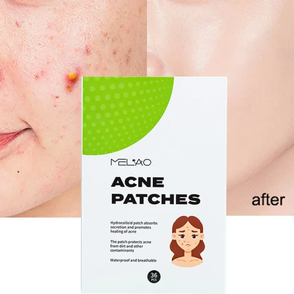 Day and Night Acne Pimple Patches for Face Invisible Spot Patches Covering and Blemishes with Tea Tree Salicylic Acid 30 Patches - Image 3