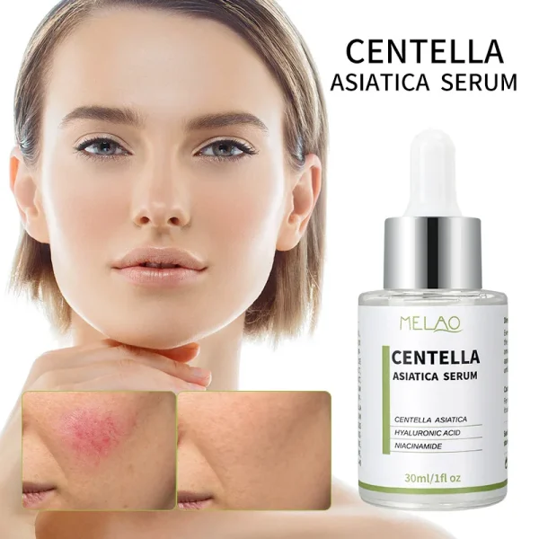 Moisturizes Treatment Soothing Anti Aging Akorean Cosmetic Whitening Vitamin c Skin Care Centella Asiatica Serum for Face - Image 4