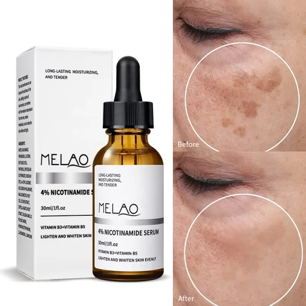 Korean Beauty Cosmetic Facial Skin Care Serum Collagen Anti Aging Whitening Face Care Vitamin C 4% Niacinamide Serum for Face - Image 2