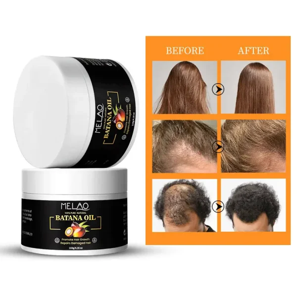 Private Label Deeply Moisturize Wholesale Natural Organic Smooth Repair Dryness Prevent Hair Loss Hair Growth Batana Oil - Image 3