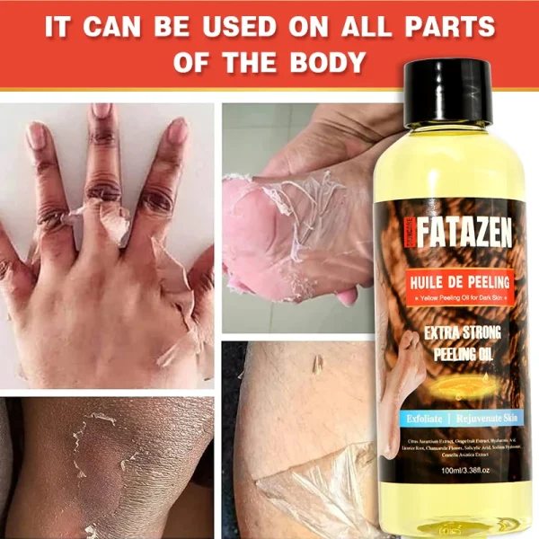 FATAZEN New Arrive Black Skin Strong Bleaching Oil Dead Skin Remover Body Face Care Extra Strong Whitening Yellow Peeling Oil - Image 2