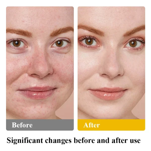 Natural Facial Private Label Body Lotions Vitamins Face Care Cosmetic Korean Skin Care Products Makeup Peptides Beef Tallow Balm - Image 6