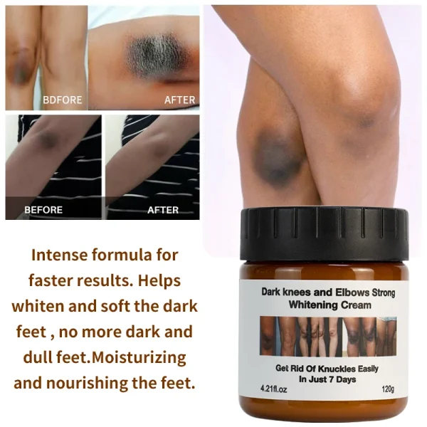 Private Label Extreme Whitening Anti Dark Spot Aging Wrinkle Knees Elbows Strong Vitamin White Lotion Face Body Whitening Cream - Image 4